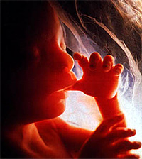 Аборты: оправдываемая жестокость