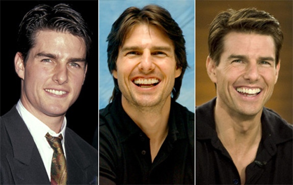 Зубы звезд до и после: сравни фотографии