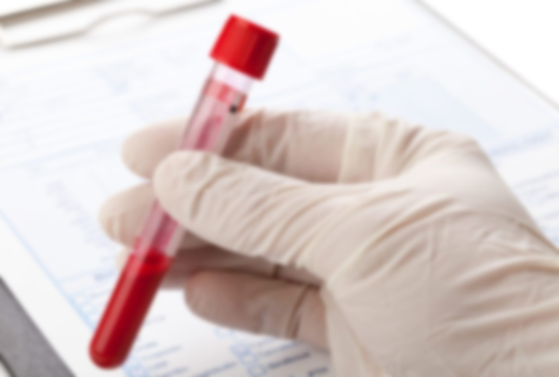 Анализ крови у ребенка лейкоциты выше нормы