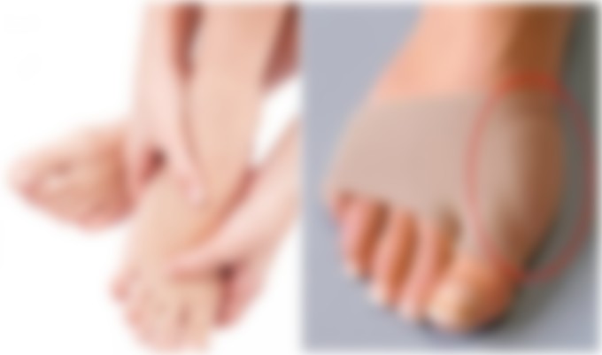 Болит шишка на ноге на большом пальце ноги лечение