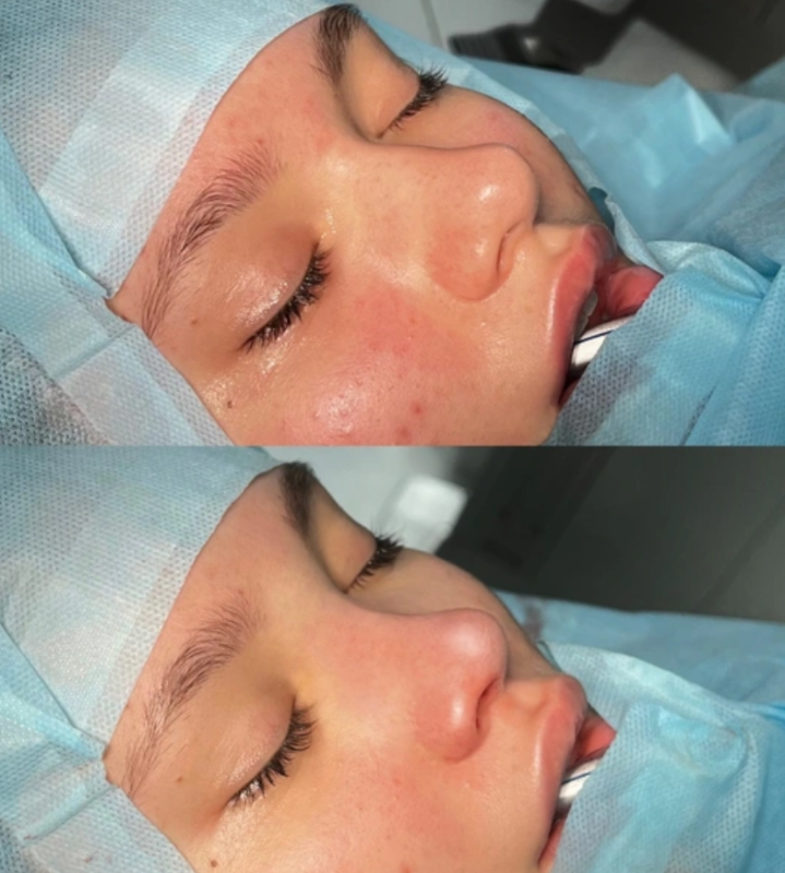 Фото: соцсети / @babayanplastic