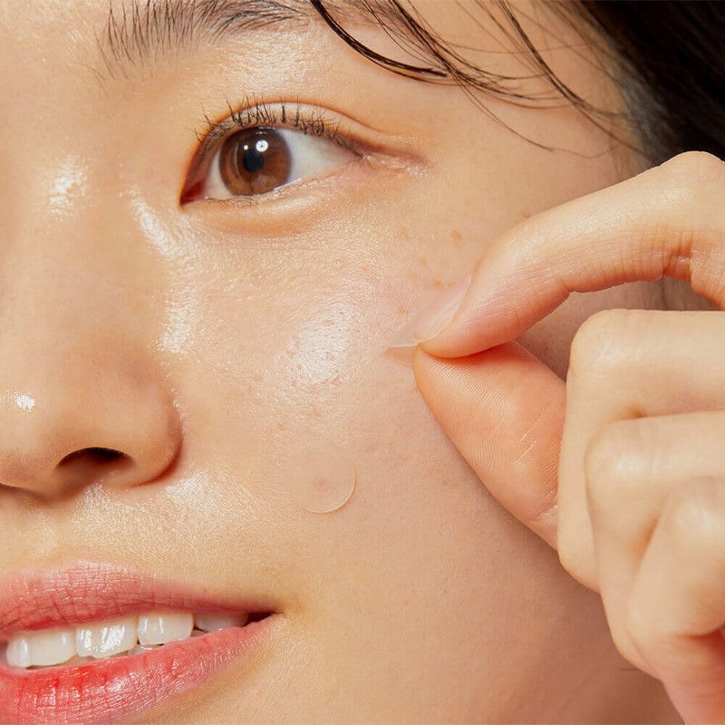 Фото: архивы пресс-службы COSRX. Наклейки от прыщей Acne Pimple Master Patch