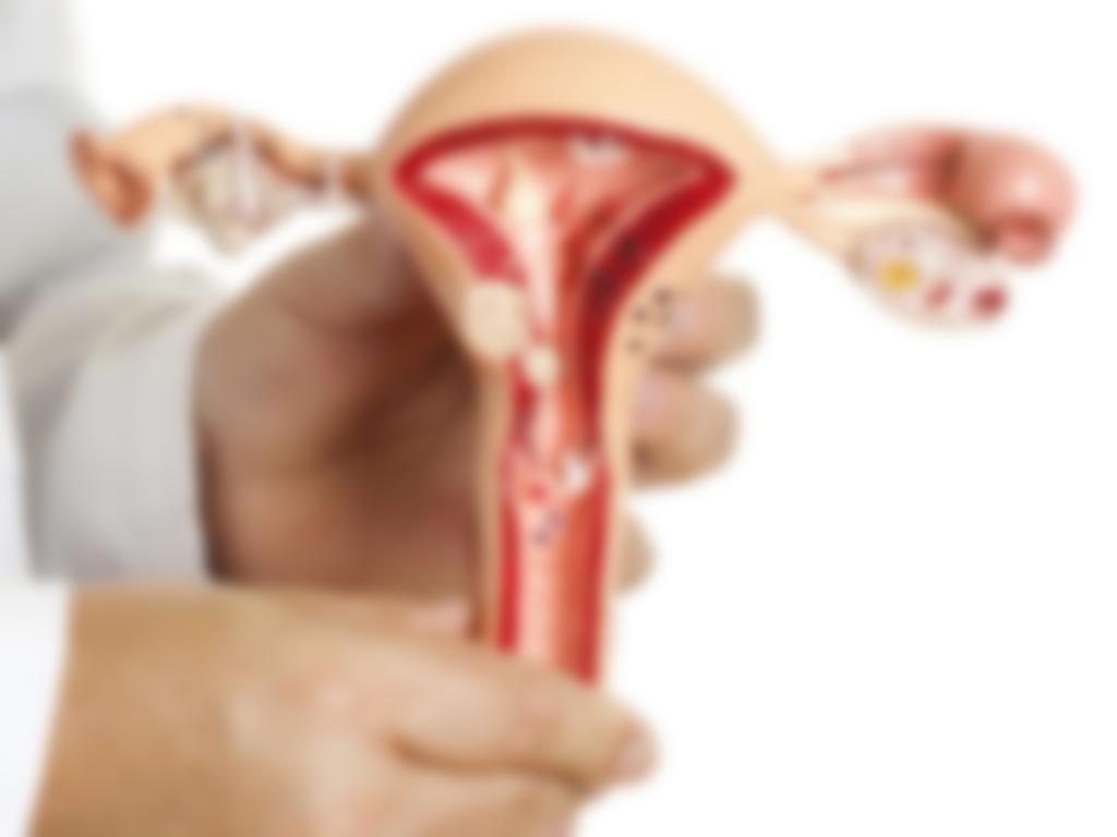 Как вылечить воспаление яичников у женщин
