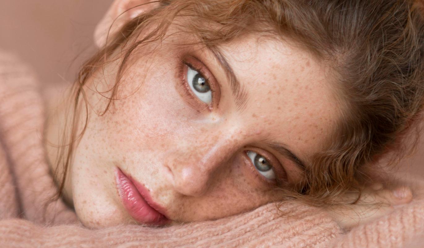 Первые лучи - первые пигментные пятна: как избежать пигментации с приходом весны