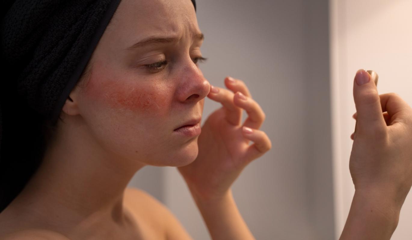 Дерматолог Николаева рассказала, почему кожа раздражается весной даже если нет аллергии