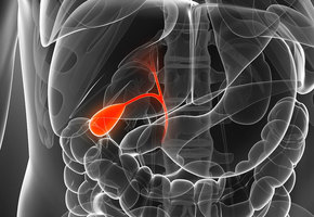 Камни в желчном пузыре - симптомы и лечение